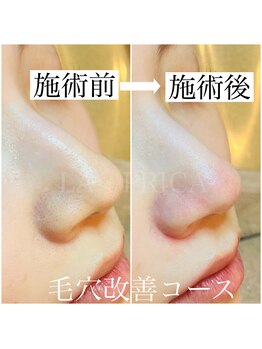 ラピリカ(LA PRICA)/