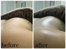 エクラニーク(Eclanique)/たった一回の施術で★Boin★