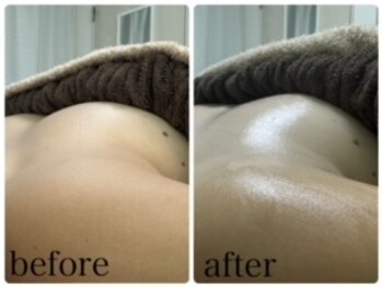 エクラニーク(Eclanique)/たった一回の施術で★Boin★