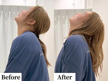 ソレア(Solea)/肩こり・首こり改善1回目