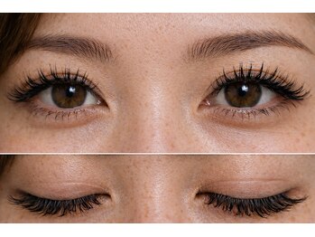 チック(chick)/LEDハイブリッド100束