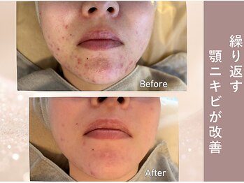 エヴァル(ewalu)/ー 6ヶ月の変化 ー