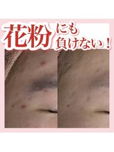 アルムダアクア 天王寺店(Aleumda AQUA)/