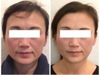 美容整体ウェリナ あま甚目寺院/小顔矯正/骨盤矯正/美脚サロン