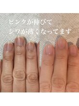 スティラ(Stila)/自爪育成/深爪育成/ネイルケア