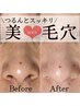頑固な汚れを一気にお掃除!!【毛穴スッキリつるつるコース】70分 ¥8,800
