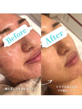 サロンドゥードゥー(SALON DOUDOU)/憧れのノーファンデ女子に♪