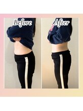 すばる整体院 小牧/ダイエット/産後骨盤矯正/小牧