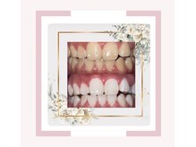 プラチナムビューティー 鳥取店(platinum beauty)