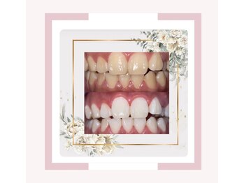 プラチナムビューティー 鳥取店(platinum beauty)