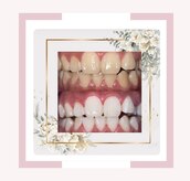 プラチナムビューティー 鳥取店(platinum beauty)