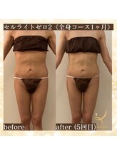 サロン カピリナ(salon Kapilina)/【before→after】