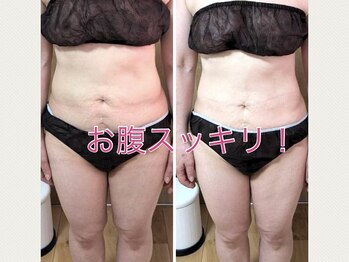 ヨサパーク ひだまり 日立店(YOSAPARK)/脇腹がスッキリ