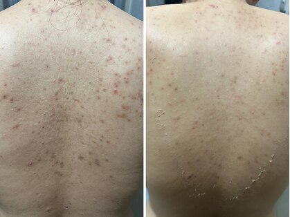 ビエストラ(Biestora)の写真