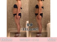 アメリイ 百合ヶ丘 新百合ヶ丘(Amerii)/【痩身】全身-131,1cm痩せました