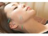 12月~【美容鍼&小顔矯正】リフトアップと美肌へ導く 45分¥6,930→