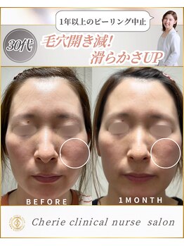 シェリー(Cherie)/毛穴の開きを収縮！滑らかさUP