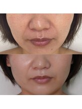 リトルーム(Litroom: from Seoul)/エイジングケア