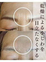 ヘッドミント 福井店/ナノプラズマ