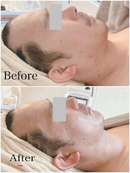 リブ 三軒茶屋(LiB)/メンズお客様OK！！