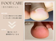 グレースネイルファクトリー(grace'nail factory)/ジェルをしながら巻き爪改善