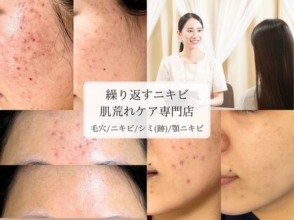 ミリアージュ(Miliage)の写真