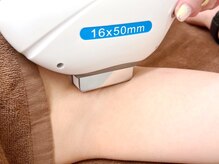 バーニー 梅田店(BARNEY)/施術イメージ４【女性】