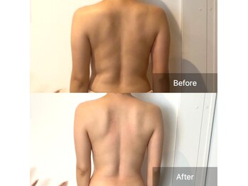 サロンツキ(salon tuki)/【バストケア】症例★