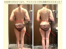 ザ モアナテラス(THE MOANA TERRACE)/小尻と美脚が叶う！