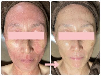 アブソリュートワン(absolute1)/NEW☆バクチ甦生プログラム