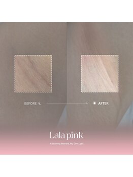 グラッソ(GRASSO)/ララピンク