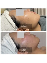 カノン(Kanon)/レモンボトルと美白でツヤツヤ肌