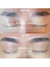 クリル(Kuril)/ビフォーアフター40代男性♪