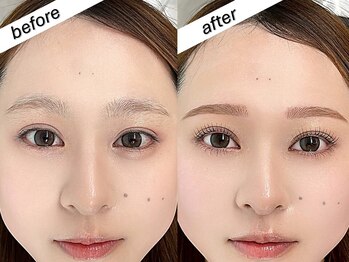 ミオ(mio.)/劇的変化【ビフォーアフター】