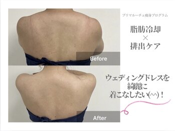 プリマルーチェ/駆け込み花嫁様☆ブライダル