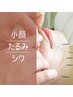 【たるみ/シワ/小顔】"60分"肌質改善美顔鍼　スッキリ小顔矯正コース