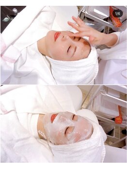 プランス 福岡(PLANCE)/フェイシャルエステ/福岡/ニキビ