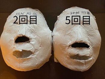 パール/石膏パックのビフォーアフター