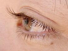 ダズル(DAZZLE)/フラットラッシュ100本