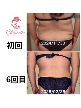 シュエット ビューティー&リラクゼーション(chouette)/【スーパースリム】