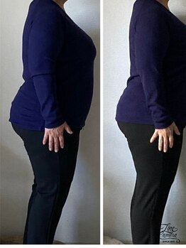 アフェ(afe)/施術