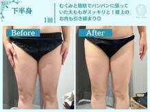 フローフシ∞/【痩身】下半身・お尻の脂肪撃退