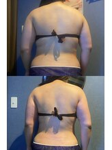 優来 神田店/肩甲骨施術の例