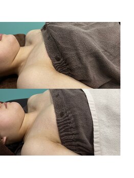 アリュール(Allure)/バストケア（２０代女性）