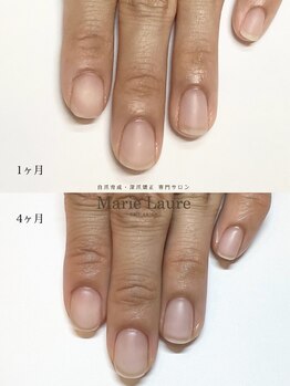 マリーロール 梅田店(Marie Laure)/自爪育成/深爪矯正/ネイルケア
