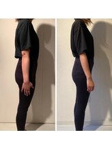 ザ エスアップ 博多店(THE S-UP)/施術前後写真