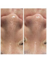 モカプラス(mocha plus)/