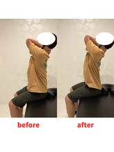 ナオル整体 福岡香椎院(NAORU整体)/30代男性施術事例【背部柔軟性】