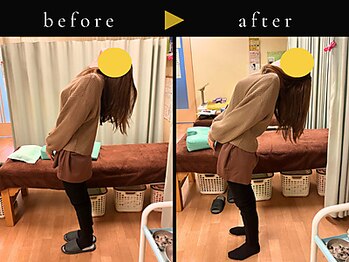杉本接骨鍼灸院/背骨から全身がユルユル整体