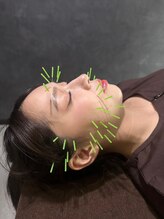 クリアランス 南青山(CLEARANCE)/美容鍼